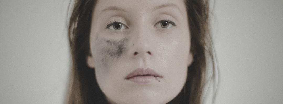 SHOUT! W/ CHARLOTTE DE WITTE event cover